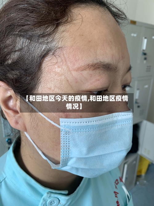 【和田地区今天的疫情,和田地区疫情情况】-第2张图片